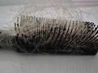 Haarausfall bei Frauen: Ein unterschätztes Thema, über das wir sprechen sollten